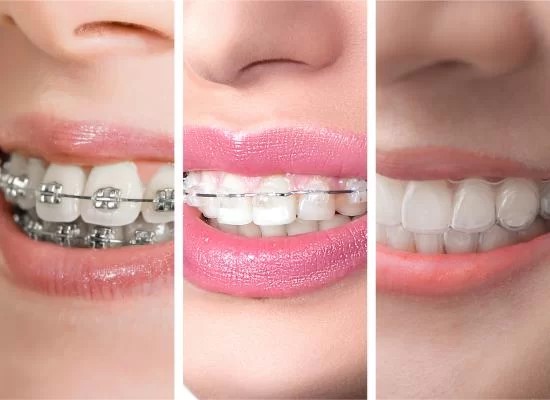 Orthodontics Treatment in Hanamkonda, Warangal