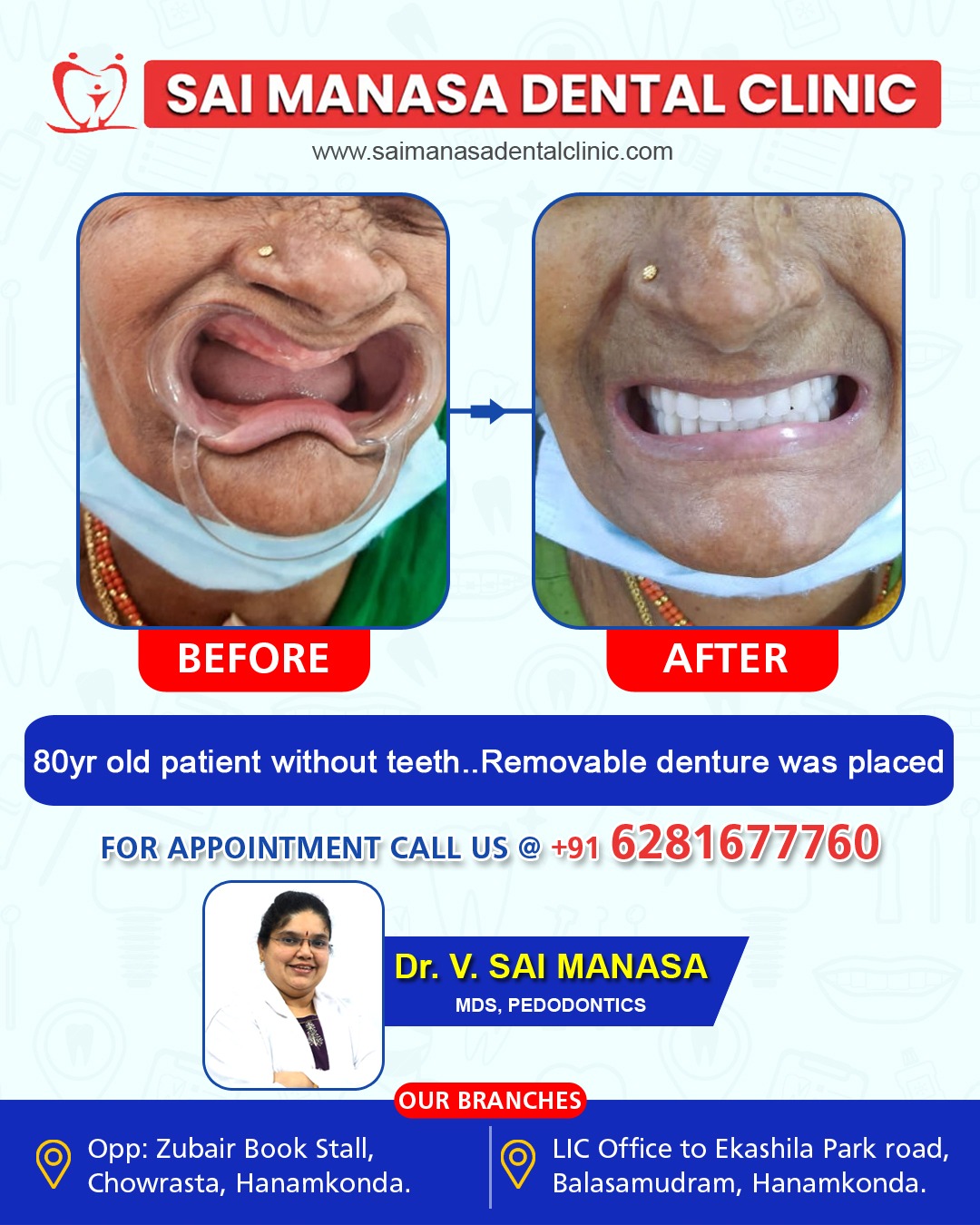Before and after dental treatment