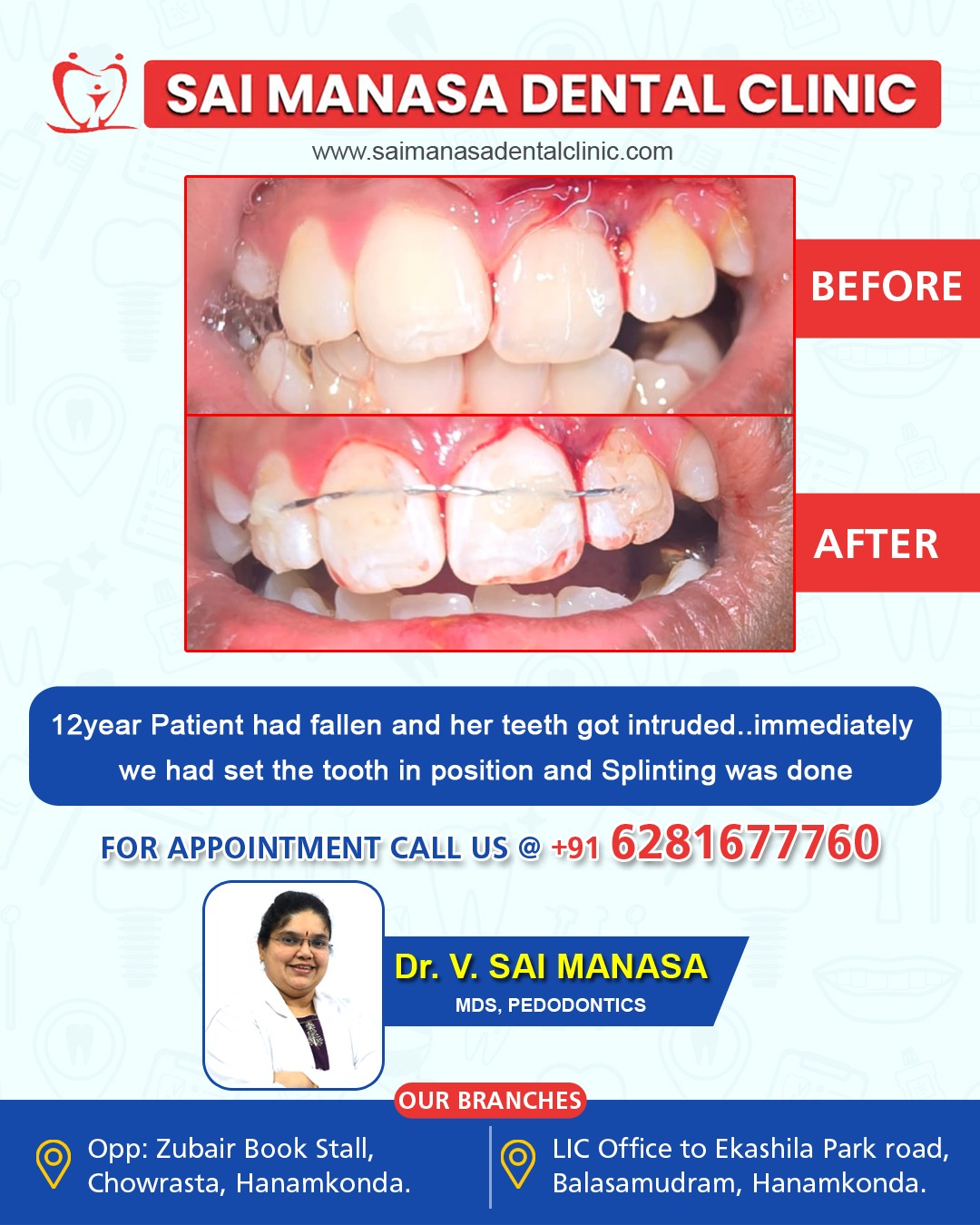 Dental trauma treatment