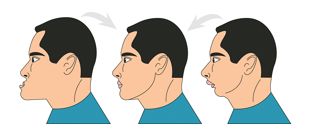 Oral and maxillofacial surgery
