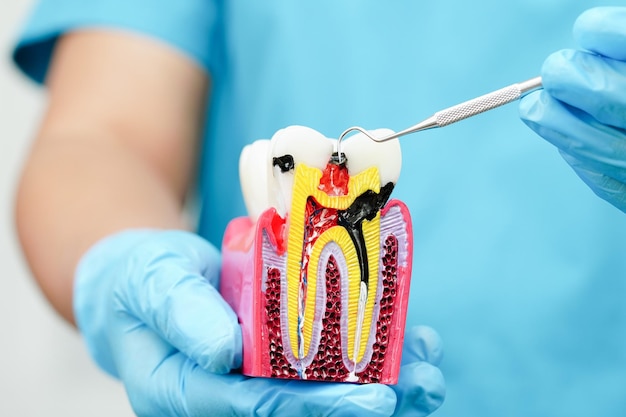 Root canal treatment